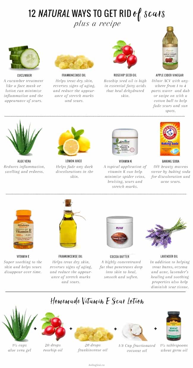 12 Natural Ways to Get Rid of Scars Hello Glow