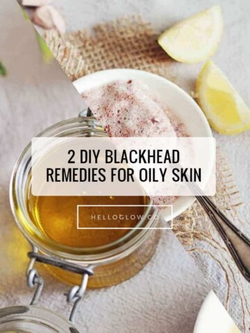 2 Blackhead Remedies for Oily Skin - HelloGlow.co