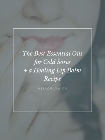 The Best essential oils for cold sores
