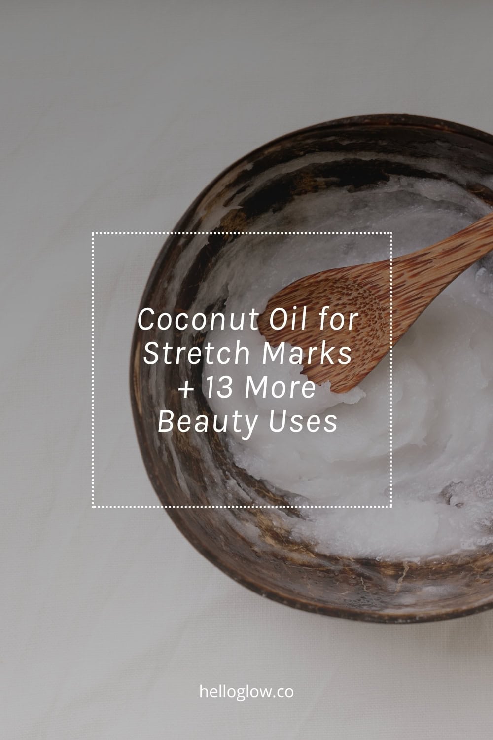 Coconut oil for stretch marks