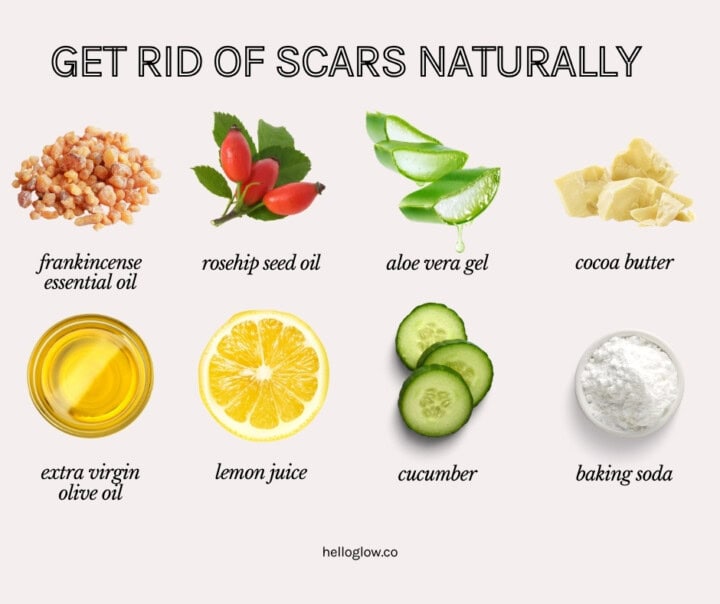 Scar remedies