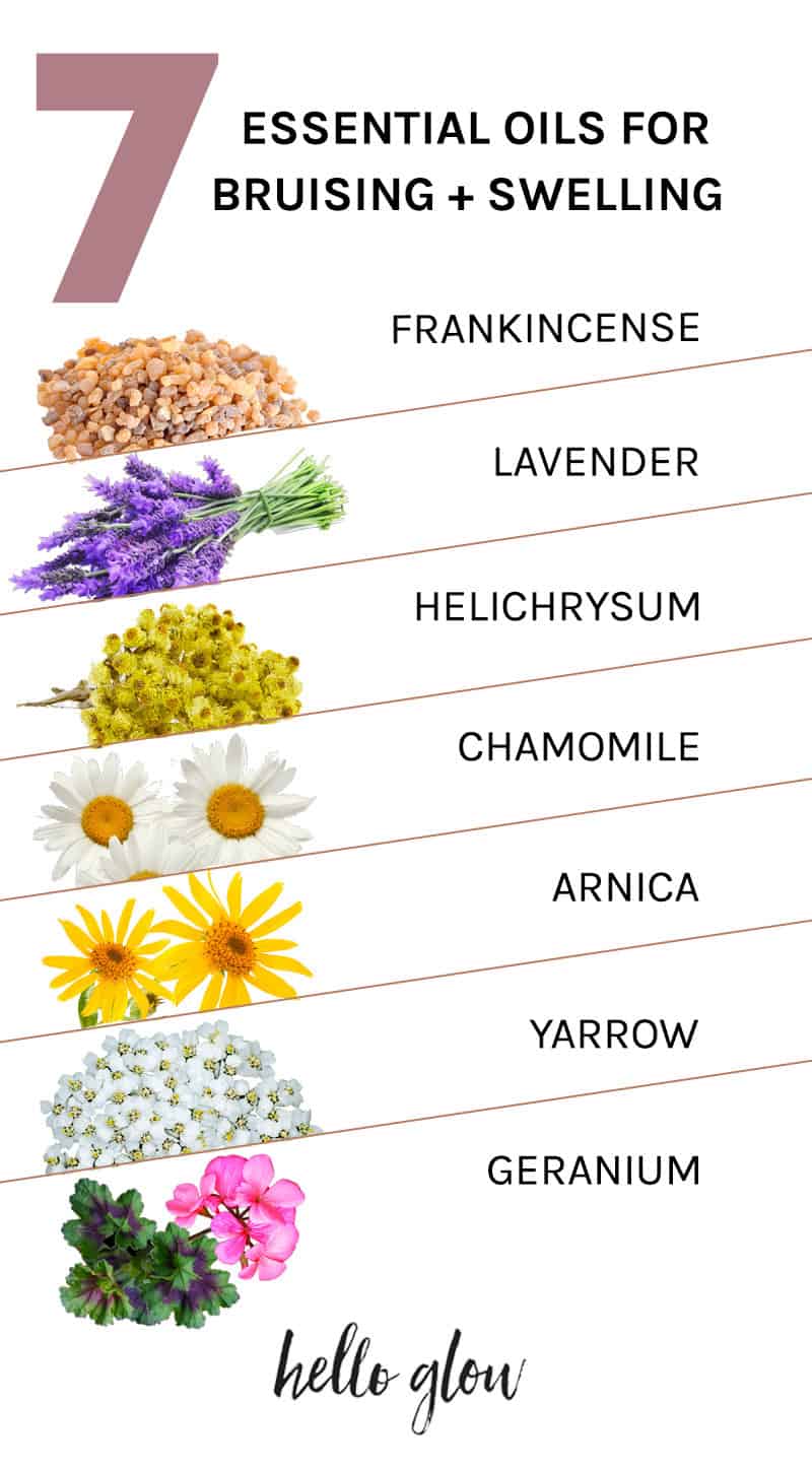 The best essential oils for bruising + swelling