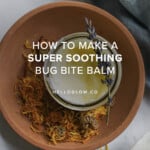 How to Make a Super Soothing Bug Bite Balm