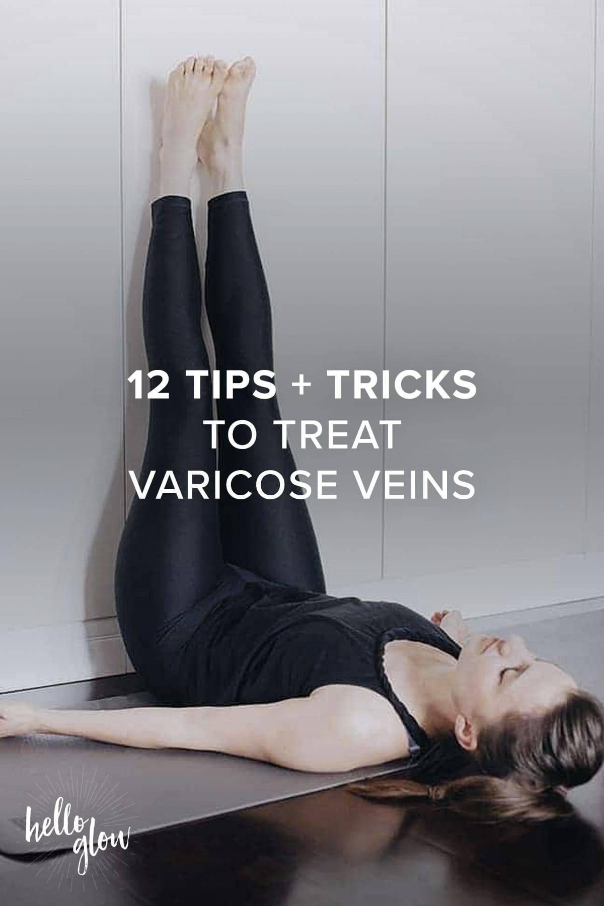 12 Tips + Tricks to Treat Varicose Veins