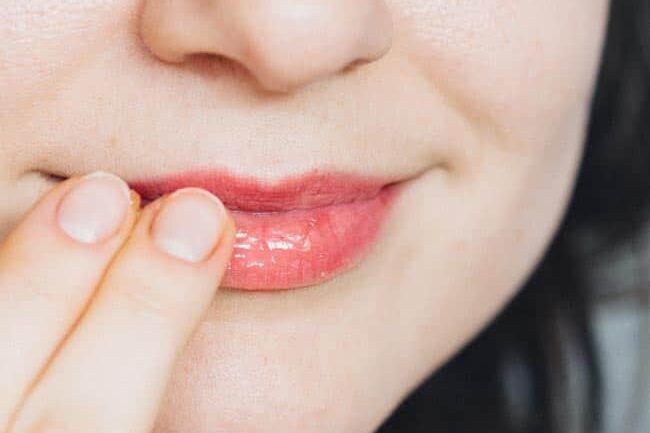 How to get soft lips