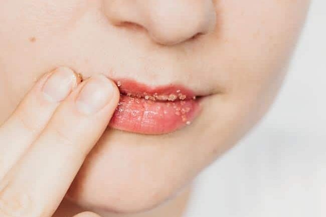 Lip Scrub | 8 Beauty Uses for Coconut Oil Lip Scrub | 9 Beauty Uses for Coconut Oil
